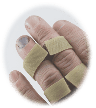 An injured finger in a splint, which could be part of a Dix Hills personal injury claim