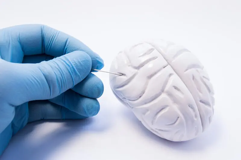 A gloved hand piercing a brain as an abstract representation of the NeuroBlate system 