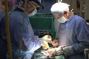 Healthy Kidney Removed