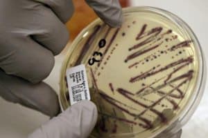 E Coli Outbreak More Widespread In Ny
