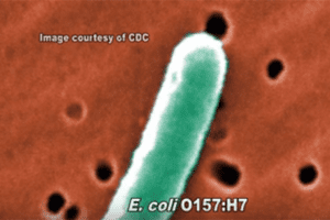 E. coli suspected