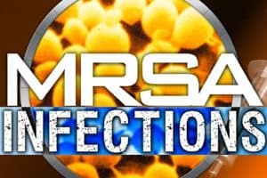 MRSA Cases