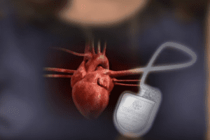 Boston scientific settles probe over defibrillators