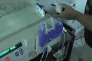 Pro Dialysis Machines