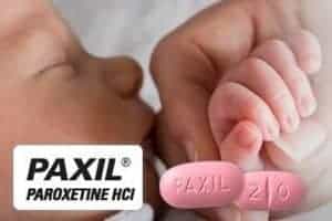 Paxil Birth Defect