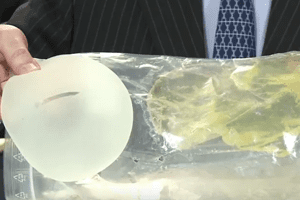 French Made Silicone Breast Implant Scare