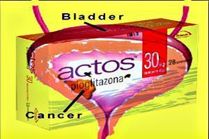 Actos Bladder Cancer Lawsuit