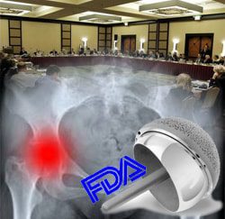 FDA Panel Takes up Metal-on-Metal Hip Implant Safety Today