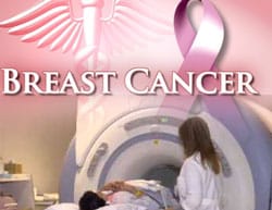Limiting Medical Imaging Can Reduce Breast Cancer Risk