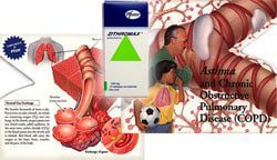FDA Calls Pfizer Zithromax Brochure was False and Misleading