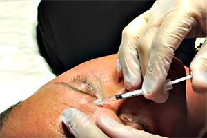 Fda targeted illegal botox from canada