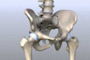 Depuy’s Chief Exec Testifies On Knowledge Of Asr Hip Implant During Trial’s Fourth Day