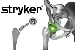 stryker_hip_injuries