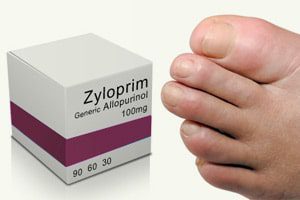 gout_drug_zyloprim_hypersensitivity_risks