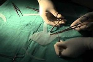 Safety probe of pelvic mesh underway in europe