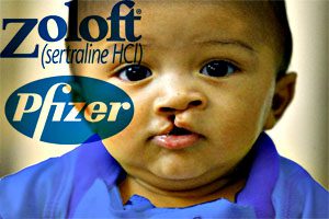 Link between zoloft and birth defects identified