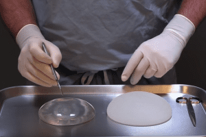 Sientra tells us surgeons to stop using breast implants