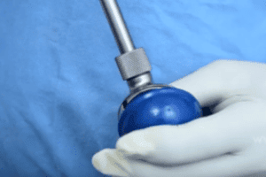 MicroPort Hip Replacement Device
