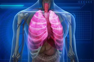 Rex medical ivc filter caused pulmonary embolism
