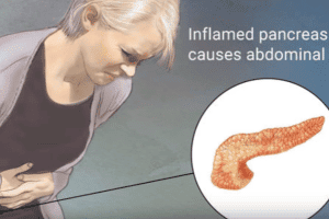 Pancreatitis_Disease