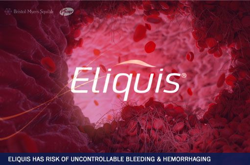 Class action lawsuit: eliquis has risk of uncontrollable bleeding, hemorrhaging