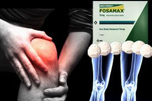 Fosamax, other bisphosphonate drugs linked to femur fractures, osteonecrosis of the jaw and other complications