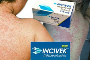 Hepatitis c drug incivek can lead to deadly skin reaction