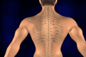 Spinal cord injury lawsuits