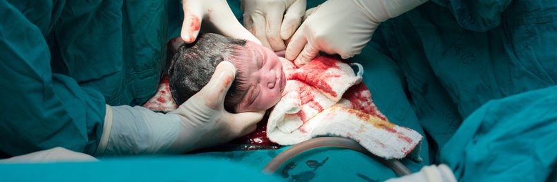 Details Regarding C-Section Delivery Birth Injury And Complications
