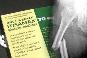 fosamax increases bone fracture