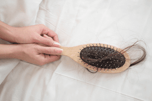 Taxotere alopecia hairbrush