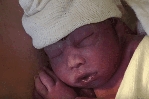 Zoloft lawsuit filed over baby’s anencephaly