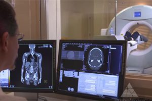 Cedars-sinai at center of ct scan radiation overdosing probe