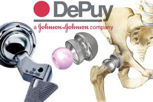 DePuy Pinnacle Hip Recalls Lawsuits