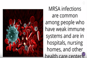 Er workers often infected with mrsa