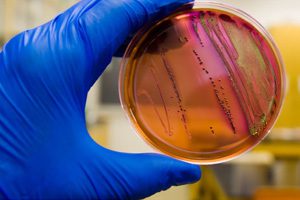 E. coli outbreak under investigation in ohio