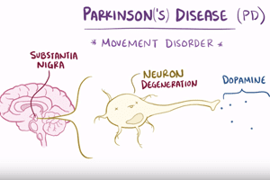 Exposure to pesticide ziram associated with higher risk of parkinson’s disease