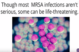 Mrsa fight hindered by lack of hand washing in hospitals