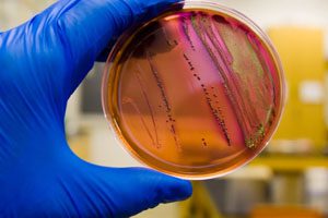 More E. coli Outbreaks