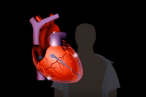 Heart-Related Problems