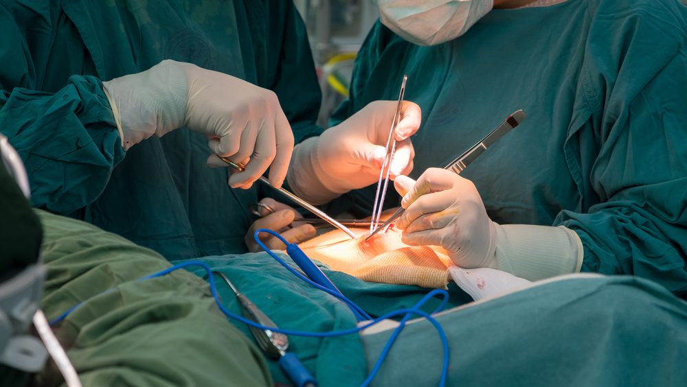 Ivc filter lawsuits allege retrieval complications, perforation