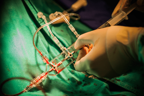 Series of medical catheter recalls