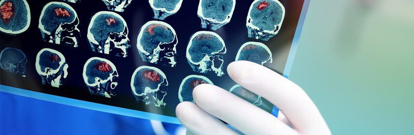 Deatails about Traumatic Brain Injury As Injuries Rises