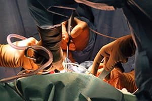 Revision Surgery Continues to Increase With Hip Recipients 