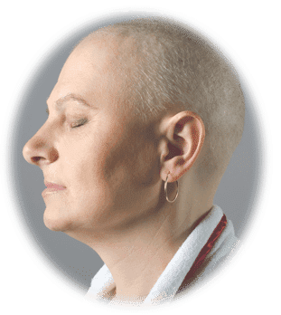 The Deep Psychological Impact of Hair Loss in Women