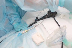 Contaminated Endoscope Lawsuit