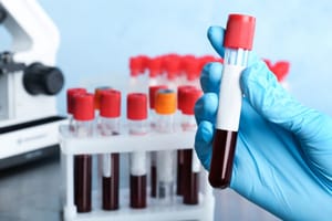 FDA Warns about Idhifa Blood Disorder