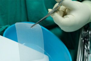 Woman Required 9 Surgeries Following Implantation of Mesh Implant