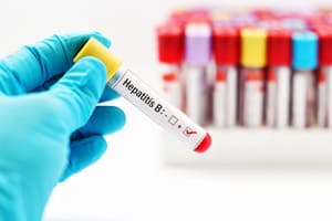 Fatal Hepatitis B Virus Reactivation Complication Linked to Darzalex