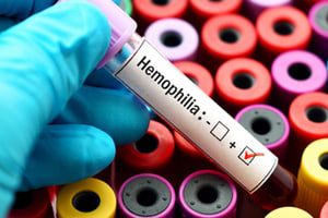 Bayer recalls mislabeled vials of hemophilia drug